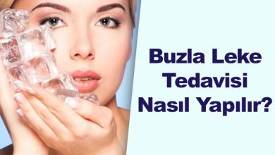 Photo of Buzla Leke Tedavisi Nasıl Yapılır?
