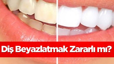 Photo of Diş Beyazlatmak Zararlı mı?